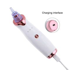 Electric Vacuum Blackhead Acne-removing Artifact Black Spot Pore Cleaner