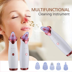 Electric Vacuum Blackhead Acne-removing Artifact Black Spot Pore Cleaner