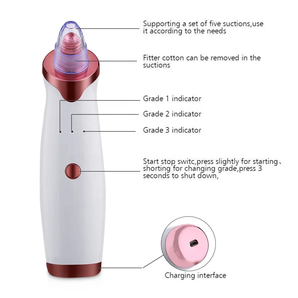 Electric Vacuum Blackhead Acne-removing Artifact Black Spot Pore Cleaner