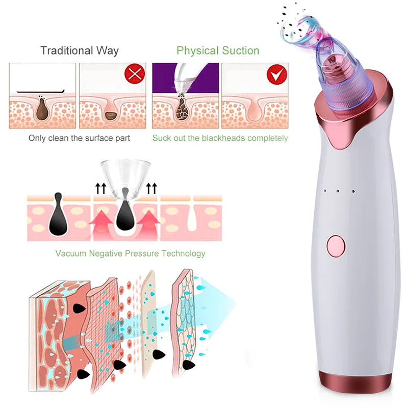 Electric Vacuum Blackhead Acne-removing Artifact Black Spot Pore Cleaner