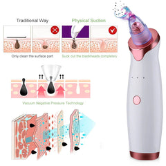Electric Vacuum Blackhead Acne-removing Artifact Black Spot Pore Cleaner